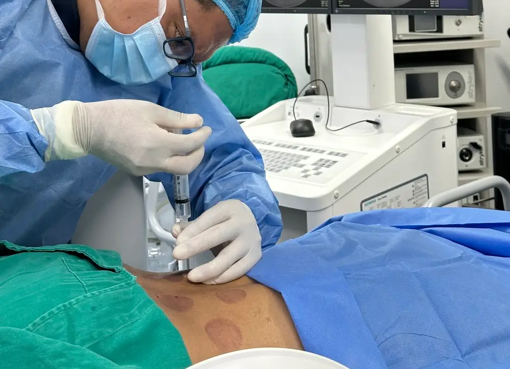 Qué es la inyección epidural para el dolor - inyección epidural Paciente en camilla preparándose para una inyección epidural lumbar- clinica del dolor