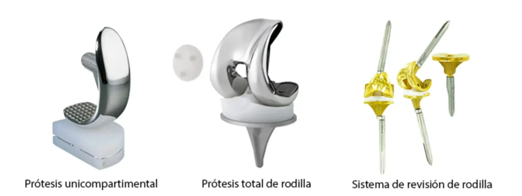 Prótesis de Rodilla: Guía Completa con Consejos Médicos y Tipos de Cirugía Explicados | prótesis de rodilla Tipos-de-protesis-de-rodilla-clinica-de-traumatologia-quirurgica-scaled