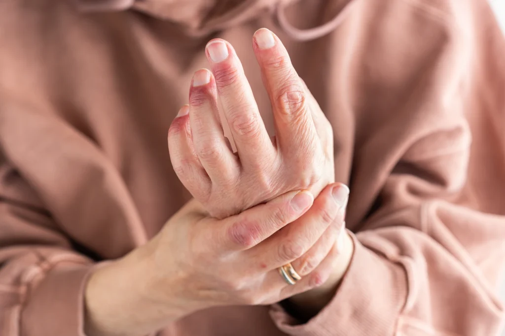 dolor de artritis y artrosis - clinica del dolor