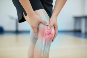 rodilla inflamada con derrame articular - clinica del dolor